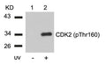 Western blot analysis of extracts from Hela cells untreated(lane 1) or treated with UV(lane 2) using CDK2(Phospho-Thr160) Antibody .