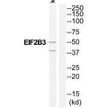 Western blot analysis of extracts from Jurkat cells, using EIF2B3 antibody.