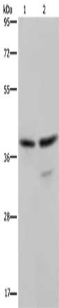 Gel: 8%SDS-PAGE, Lysate: 40 ug, Lane 1-2: Jurkat cells, Hela cells, Primary antibody: CSB-PA912911(BUB3 Antibody) at dilution 1/300, Secondary antibody: Goat anti rabbit IgG at 1/8000 dilution, Exposure time: 10 seconds