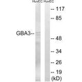 Western blot analysis of extracts from HuvEc cells, using GBA3 antibody.