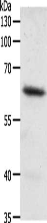 Gel: 10%SDS-PAGE, Lysate: 50 ug, Lane: Mouse heart tissue, Primary antibody: CSB-PA913541(FZD4 Antibody) at dilution 1/200, Secondary antibody: Goat anti rabbit IgG at 1/8000 dilution, Exposure time: 10 seconds
