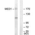 Western blot analysis of extracts from Jurkat cells, using MED1 antibody.