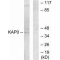 Western blot analysis of extracts from HepG2 cells, using KAP0 antibody.