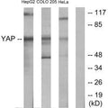 Western blot analysis of extracts from HepG2 cells, COLO205 cells and HeLa cells, using YAP antibody.