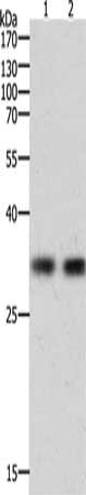 Gel: 10%SDS-PAGE, Lysate: 40 ug, Lane 1-2: k562 cells, Hela cells, Primary antibody: CSB-PA913997(HAVCR1 Antibody) at dilution 1/700, Secondary antibody: Goat anti rabbit IgG at 1/8000 dilution, Exposure time: 90 seconds