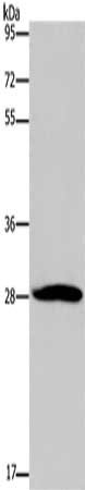 Gel: 10%SDS-PAGE, Lysate: 80 ug, Lane: A172 cells, Primary antibody: CSB-PA914135(POMCＥta endorphin＠Antibody) at dilution 1/350, Secondary antibody: Goat anti rabbit IgG at 1/8000 dilution, Exposure time: 2 minutes