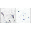 Immunohistochemical analysis of paraffin-embedded human brain tissue using Patched antibody.