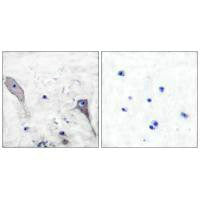 Immunohistochemical analysis of paraffin-embedded human brain tissue using Patched antibody.
