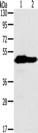 Gel: 8%SDS-PAGE, Lysate: 40 ug, Lane 1-2: Mouse heart tissue, Mouse brain tissue, Primary antibody: CSB-PA914526(NDUFV1 Antibody) at dilution 1/500, Secondary antibody: Goat anti rabbit IgG at 1/8000 dilution, Exposure time: 30 seconds