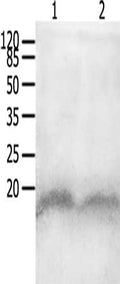 Gel: 12%SDS-PAGE, Lysate: 40 ug, Lane 1-2: 293T cells, Jurkat cells, Primary antibody: CSB-PA914583(CCL8 Antibody) at dilution 1/950, Secondary antibody: Goat anti rabbit IgG at 1/8000 dilution, Exposure time: 2 minutes