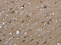 The image on the left is immunohistochemistry of paraffin-embedded Human brain tissue using CSB-PA914875(PTK2B Antibody) at dilution 1/50, on the right is treated with fusion protein. (Original magnification: ×200)