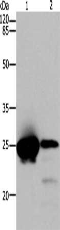 Gel: 10%SDS-PAGE, Lysate: 24 ug, Lane 1-2: Hela cells, Human endometrial cancer tissue, Primary antibody: CSB-PA914989(CBX5 Antibody) at dilution 1/300, Secondary antibody: Goat anti rabbit IgG at 1/8000 dilution, Exposure time: 1 minute