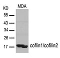 Western blot analysis of extracts from MDA cells using cofilin1/cofilin2(Ab-88) Antibody.