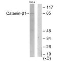 Western blot analysis of extracts from HeLa cells, using Catenin-β1 antibody.
