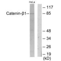 Western blot analysis of extracts from HeLa cells, using Catenin-β1 antibody.