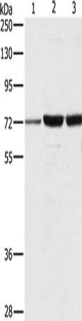 Gel: 8%SDS-PAGE, Lysate: 40 ug, Lane 1-3: A375 cells, 231 cells, hela cells, Primary antibody: CSB-PA915653(DOK1 Antibody) at dilution 1/750, Secondary antibody: Goat anti rabbit IgG at 1/8000 dilution, Exposure time: 10 minutes