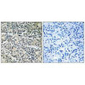 Immunohistochemistry analysis of paraffin-embedded human prostate carcinoma tissue using MP68 antibody.
