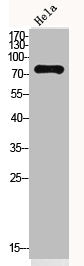 Western Blot analysis of HeLa cells using OAS2 Polyclonal Antibody