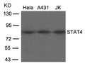 Western blot analysis of extracts from Hela, A431 and JK cells using STAT4(Ab-693) Antibody.