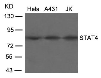 Western blot analysis of extracts from Hela, A431 and JK cells using STAT4(Ab-693) Antibody.