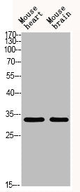 Western blot analysis of MOUSE-HEART MOUSE-BRAIN using Acetyl-TAL1/2 (K221/K222/K36/K37) antibody. Antibody was diluted at 1:500. Secondary antibody  was diluted at 1:20000