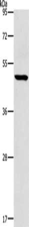 Gel: 10%SDS-PAGE, Lysate: 40 ug, Lane: Mouse heart tissue, Primary antibody: CSB-PA916643(HOXC10 Antibody) at dilution 1/225, Secondary antibody: Goat anti rabbit IgG at 1/8000 dilution, Exposure time: 20 seconds