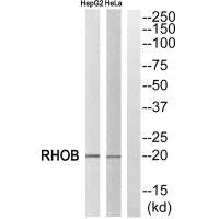Western blot analysis of extracts from HepG2 cells and HeLa cells, using RHOB antibody.