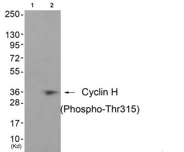 Western blot analysis of extracts from JK cells (Lane 2), using Cyclin H (Phospho-Thr315) Antibody. The lane on the left is treated with antigen-specific peptide.