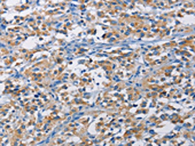 RICTOR Antibody – Figure 1 of 2