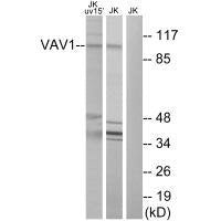 Western blot analysis of extracts from Jurkat cells, using VAV1 (Ab-174) antibody.