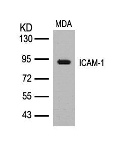 Western blot analysis of extracts from MDA cells using ICAM-1(Ab-512) Antibody.