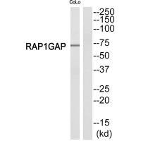 Western blot analysis of extracts from COLO205 cells, using RAP1GDS1 antibody.