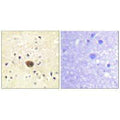 Immunohistochemistry analysis of paraffin-embedded human brain tissue using Ras-GRF1 antibody.
