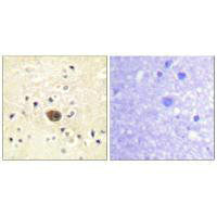 Immunohistochemistry analysis of paraffin-embedded human brain tissue using Ras-GRF1 antibody.