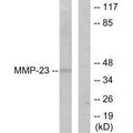 Western blot analysis of extracts from SK-OV3 cells, using MMP-23 antibody.