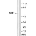 Western blot analysis of extracts from NIH/3T3cells, treated with PDGF (50mg /ml, 20mins), using Akt (Ab-124) antibody.