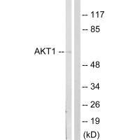 Western blot analysis of extracts from NIH/3T3cells, treated with PDGF (50mg /ml, 20mins), using Akt (Ab-124) antibody.