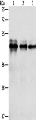 Gel: 10%SDS-PAGE, Lysate: 40 ug, Lane 1-3: Jurkat cells, hela cells, MCF7 cells, Primary antibody: CSB-PA919532(NFKBIB Antibody) at dilution 1/950, Secondary antibody: Goat anti rabbit IgG at 1/8000 dilution, Exposure time: 10 seconds