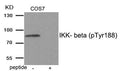 Western blot analysis of extracts from COS7 tissue using IKK- beta (Phospho-Tyr188) antibody.The lane on the right is treated with the antigen-specific peptide.