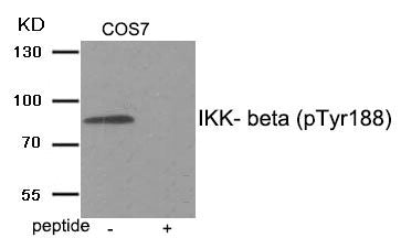 Western blot analysis of extracts from COS7 tissue using IKK- beta (Phospho-Tyr188) antibody.The lane on the right is treated with the antigen-specific peptide.