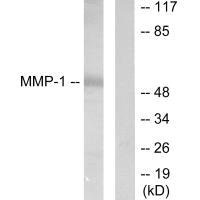 Western blot analysis of extracts from HepG2 cells, using MMP-1 antibody.
