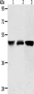 Gel: 10%SDS-PAGE, Lysate: 40 ug, Lane 1-3: Human brain malignant glioma tissue, human fetal kidney tissue, A172 cells, Primary antibody: CSB-PA920538(ACOT9 Antibody) at dilution 1/600, Secondary antibody: Goat anti rabbit IgG at 1/8000 dilution, Exposure time: 5 seconds