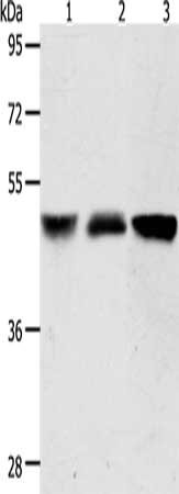 Gel: 10%SDS-PAGE, Lysate: 40 ug, Lane 1-3: Human brain malignant glioma tissue, human fetal kidney tissue, A172 cells, Primary antibody: CSB-PA920538(ACOT9 Antibody) at dilution 1/600, Secondary antibody: Goat anti rabbit IgG at 1/8000 dilution, Exposure time: 5 seconds