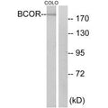 Western blot analysis of extracts from COLO cells, using BCOR antibody.
