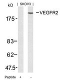 Western blot analysis of extracts from SKOV3 cells using VEGFR2(Ab-951) Antibody and the same antibody preincubated with blocking peptide.