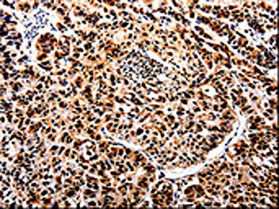 APIP Antibody – Figure 1 of 2