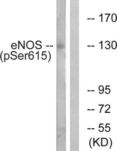 Western blot analysis of extracts from K562 cells, treated with EGF (40nM, 30mins), using eNOS (Phospho-Ser615) antibody. The lane on the right is treated with the synthesized peptide.