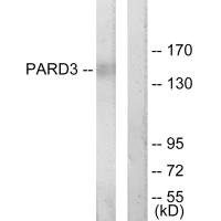 Western blot analysis of extracts from COLO205 cells, using PARD3 antibody.