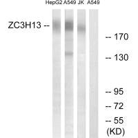 Western blot analysis of extracts from HepG2 cells, A549 cells and Jurkat cells, using ZC3H13 antibody.