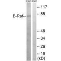 Western blot analysis of extracts from rat brain cells, using B-Raf (Ab-753) antibody.